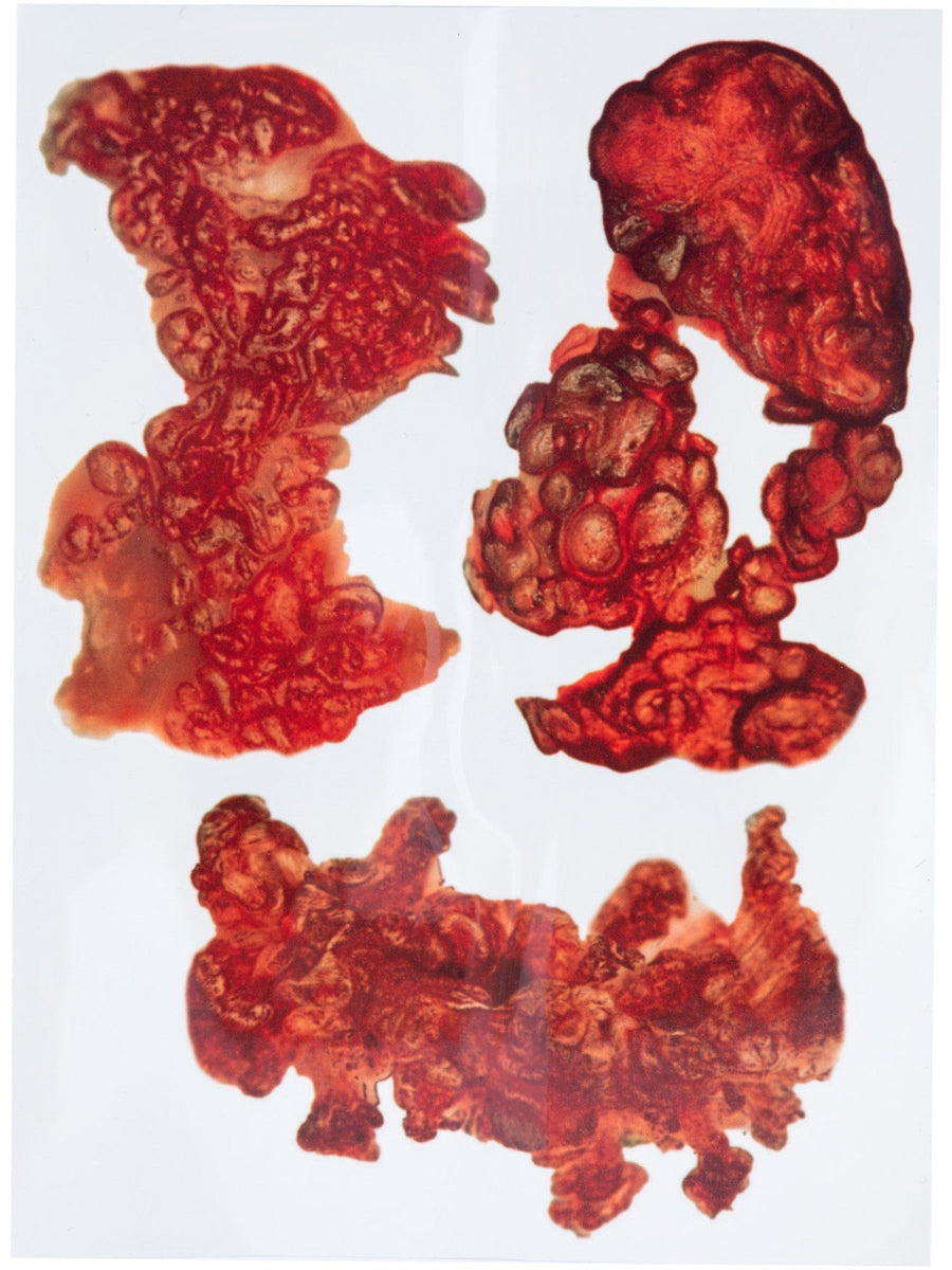Halloween Burnt Skin Temporary Tattoos - Flat Image